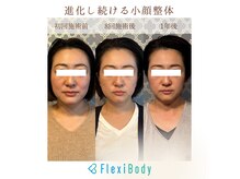 フレキシボディ(FlexiBody)の雰囲気（小顔整体の回数を重ねる事により、より確実な小顔へ導きます！）