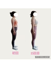 フォーシー(4C)/Before/After