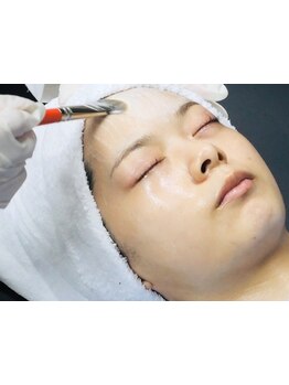 ハリツヤをUPしたい