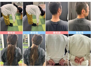 ナゴミ鍼灸 整体院(NAGOMI鍼灸 整体院)/ビフォーアフター