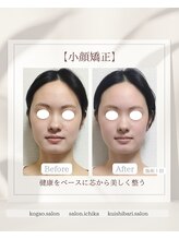 イチカ 仙川店( ichika)/骨格.顎関節.筋膜.深層から変化