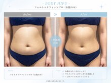 スカイトータルビューティー(Sky Total Beauty)