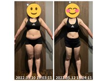 美容整体院元 光の森店/ダイエット3ヵ月　before＆after