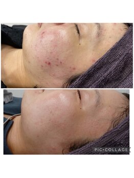 ビラ ベルダ(Bira Beldad)/