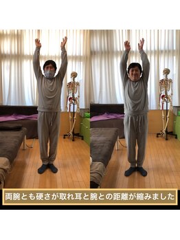 フォルム ボディアンドフェイス 恵比寿(Forme)/40代50代の方必見！腕上がります