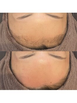 ルナート(Lunart)/速攻!!韓国美肌