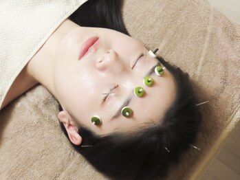 くろねこはりきゅう院の写真/眼精疲労/頭こりでお悩みの方に◎頭皮鍼＆ヘッドマッサージで凝り固まった頭を緩め脳疲労解消！