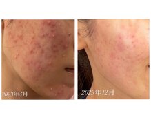 ハリーベージュ(Hariy Beige)/HariyBeige麻布十番