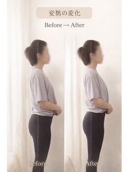 ブリリアントスマイル/骨盤矯正