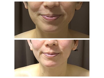 サロン シャンティーの写真