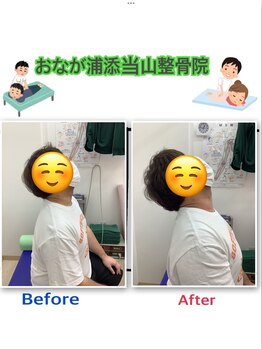 おなが浦添当山整体院/ビフォー/アフター2（頚の痛み）