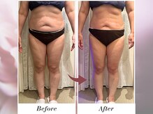 リボーン(boju reborn)/◆50代のお客様◆