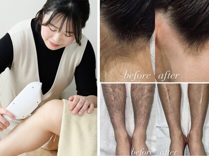 サンゴーハチ(358)の写真