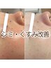 【シミ改善★】今あるシミ・くすみ改善ハーブピーリング