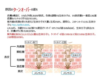リフュージュ(refuge)/安全なシミケア◎