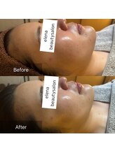 エレナ(Elena)/陶肌トリートメント