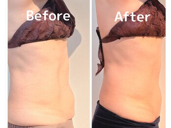 美活ラボ(美活LABO)/ビフォーアフター