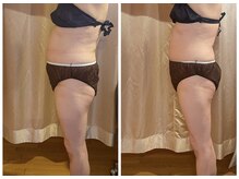 エルバード/1回でもこの変化！