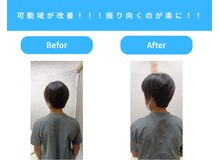きくち整骨院/痛くて動かない首の動きが改善