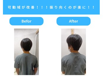 きくち整骨院/痛くて動かない首の動きが改善