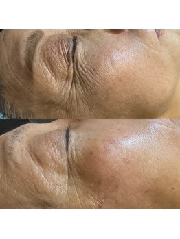 アルム(a'rme)/【シワコース】