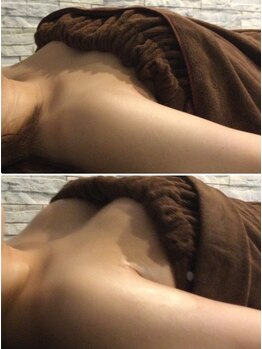 インディバ痩身サロン プルミエ(premier)/バストアップ