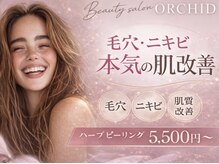 オーキッド(ORCHID)