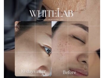 Kino Beauty Salon二子玉川店 ローマピンク/ホワイトラボ/脂肪冷却/シミ/メラニンケア/ホワイトラボ