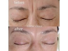 コールドゥ(Coeur-Doux)の雰囲気(☆深いシワ改善!どうしたら良いかかわからなかった方は必見☆)