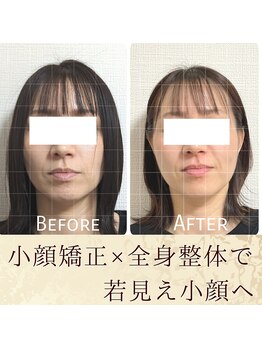 スウ(suu.)/Before-After【40代】8回