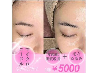 スムース イー(Smooth+E)の写真