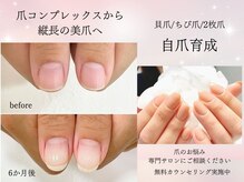 インブロッサム(imblossom)