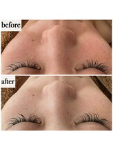 メナードフェイシャルサロン 岐阜茜部/クリーンパック