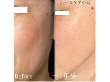 プリミエル(preMiel)の雰囲気（何気なく毎日使うだけで細胞から若々しく美しくなるホームケア）