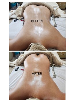 ラプタス(Rapu+)/骨盤の歪みと垂れたお尻を調整