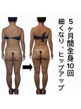 スピード美人 新宿店/スライドカッピング全身10回