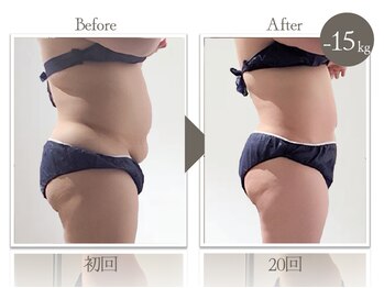 ビューティーリバース 東戸塚店/★劇的ビフォーアフター★