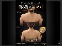 メンズアンドレディース エステティックサロン ティアラ(TiaLa)