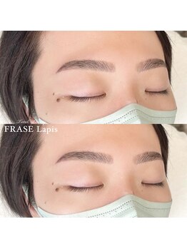 フレイズラピス(FRASE Lapis)/ハリウッドブロウリフト