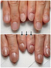 スマイルニコ(smile nico)/男爪がうる艶大人ネイルに変身