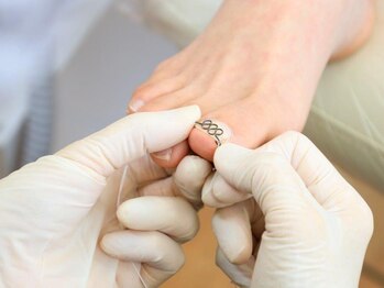 施術【5.専用器具を装着】