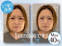 ネルジム 札幌店(NERU GYM)/１回で変わります！