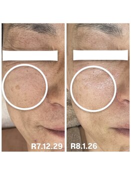 エステサロンパリス(Esthe Salon Paris)/男性の第一印象は清潔感で決まる