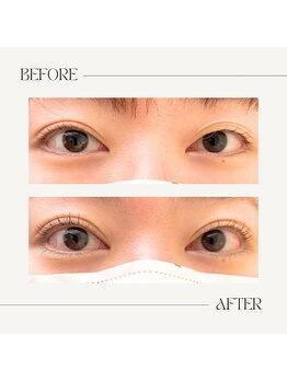 マーブル(marble)/お客様写真