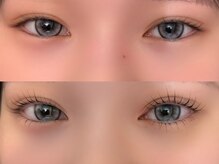 アイムア(I'M A.)/BeforeAfter
