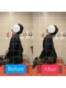 ナオル整体 宮崎院(NAORU整体)/20代男性施術事例【猫背改善】