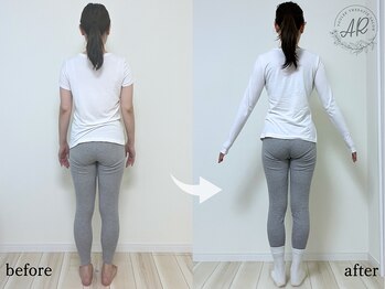 エーアール(AR)/【Before/After】6回目