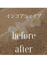 リラクゼーションサロン ラキ(laki)/インコアシェイプ