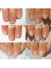 ニコプラス(NICO+)/自爪育成中