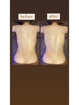 灯香庵 玉響(たまゆら)/【漢本草アロマ】before after